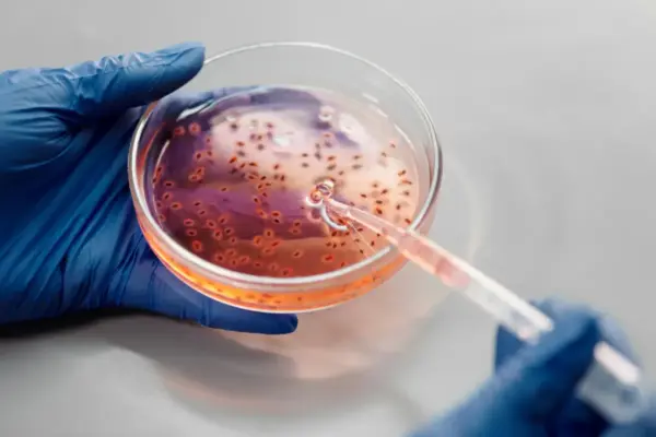 ¿El hantavirus podría convertirse en una nueva amenaza sanitaria mundial?: debate en Un Café con Fe